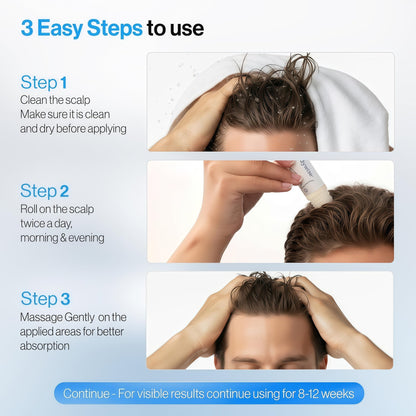 Rosemary Hair Growth Serum Roll On 25 ml – 3% Rosemary, 3% Redensyl & 2% Anagain | DHT-Blocking Scalp Serum Boosts Oxygen Flow, Reduces Hair Fall | Paraben/Sulfate-Free | Women & Men